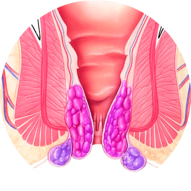 Gelarex облекчава симптомите още от първата употреба
